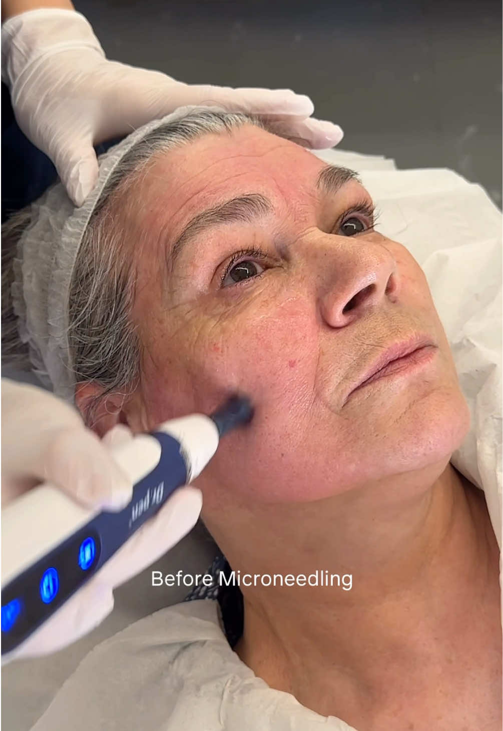 @tendentalfacial