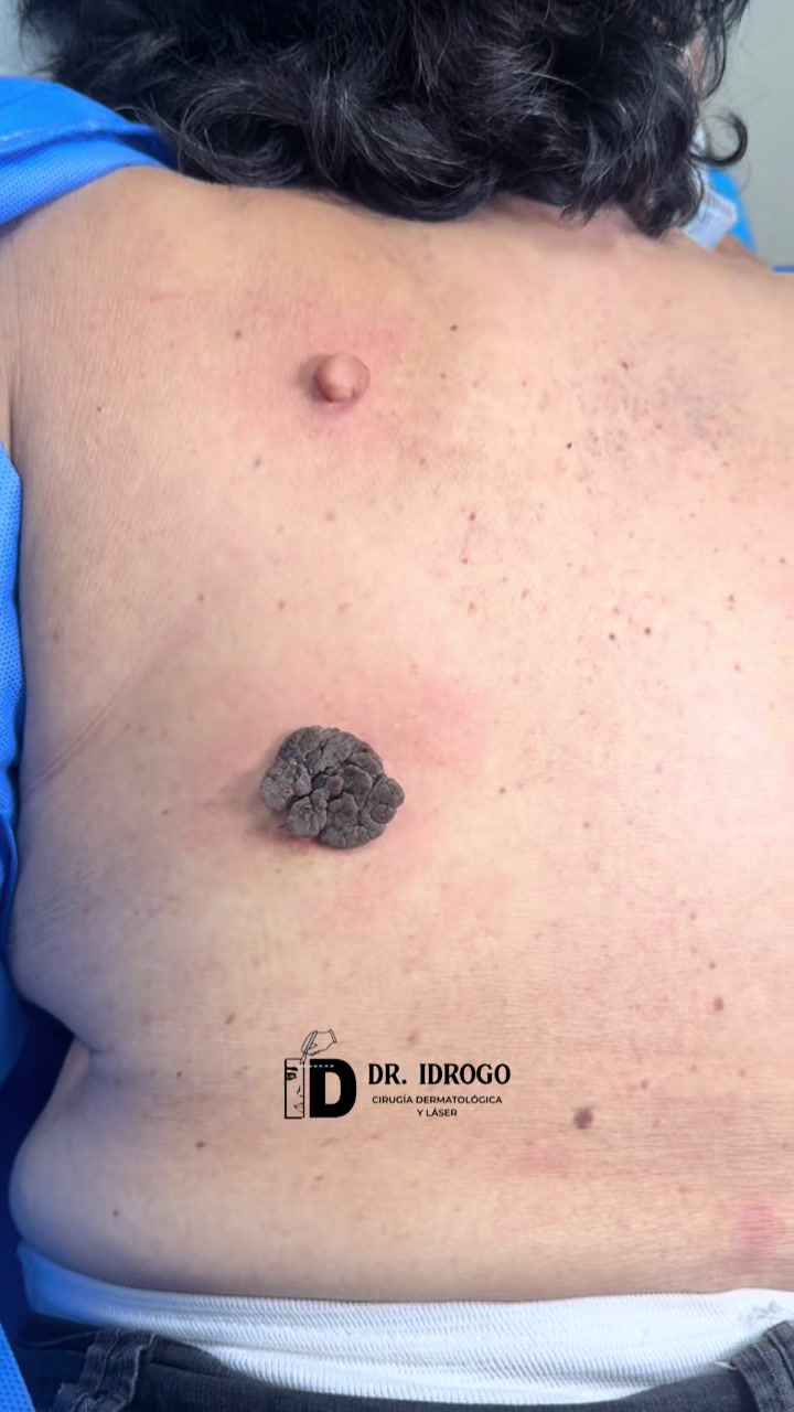 @dr.idrogodermatologo