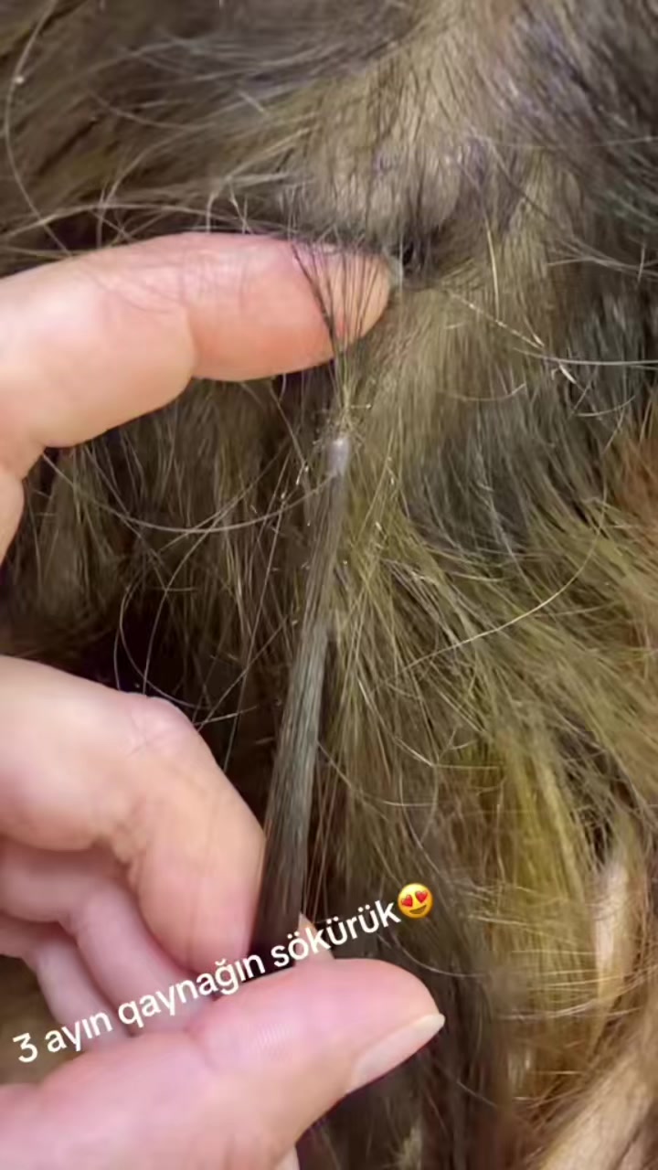 @G&uuml;lnur Quluzadeh💎
