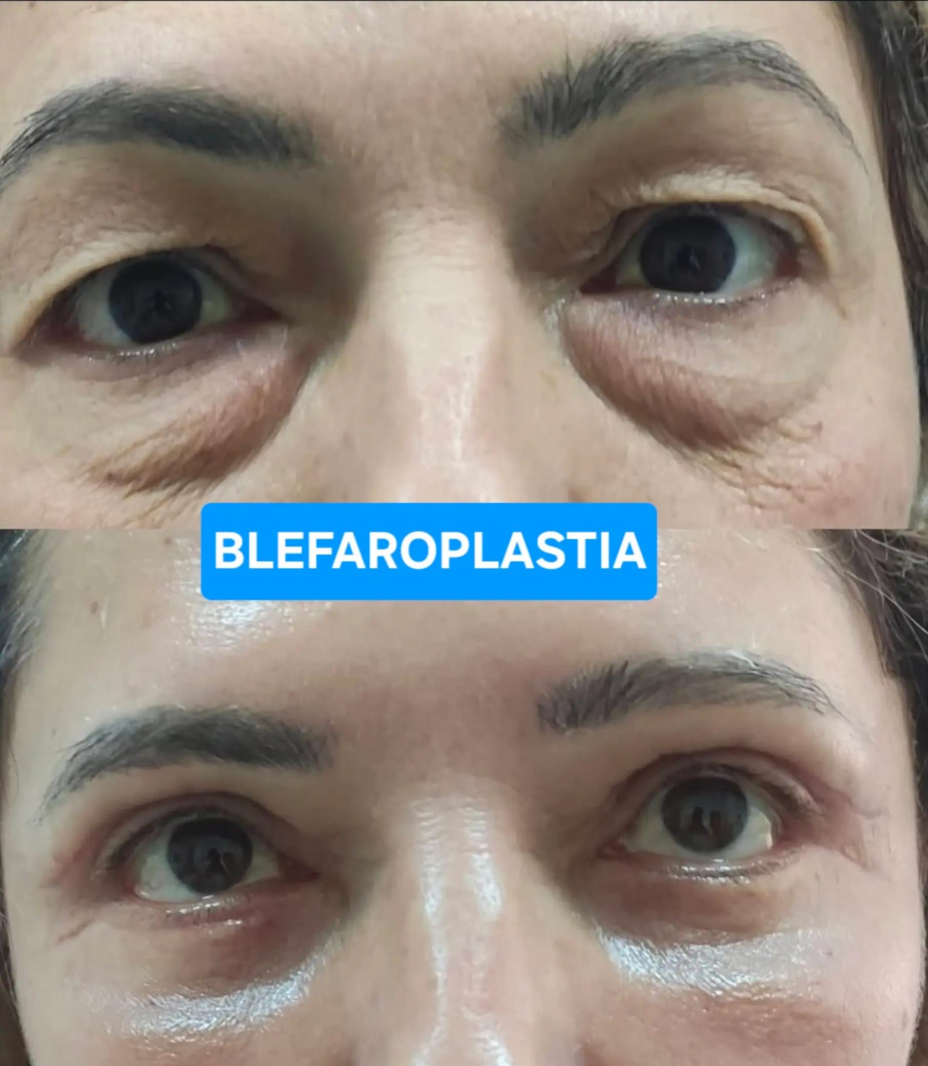@Belanovacirugiaplastica
