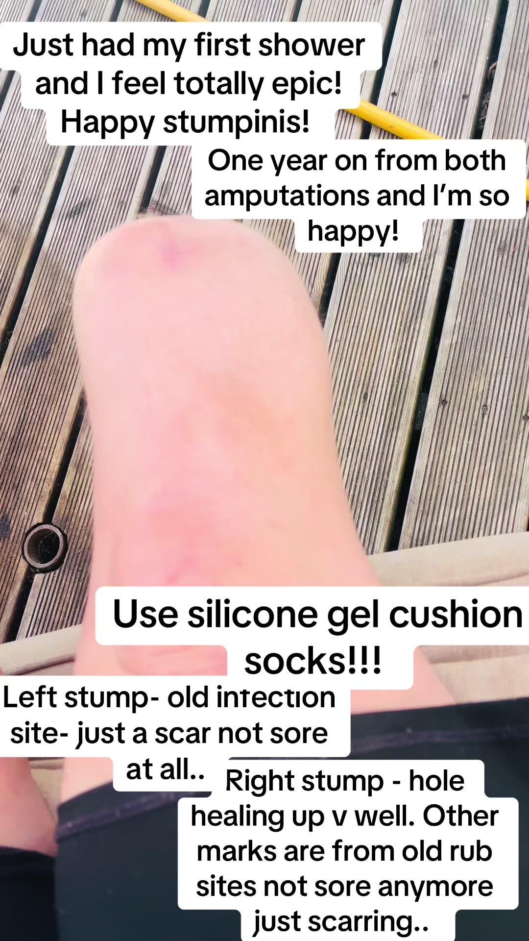 @stumpinis_82