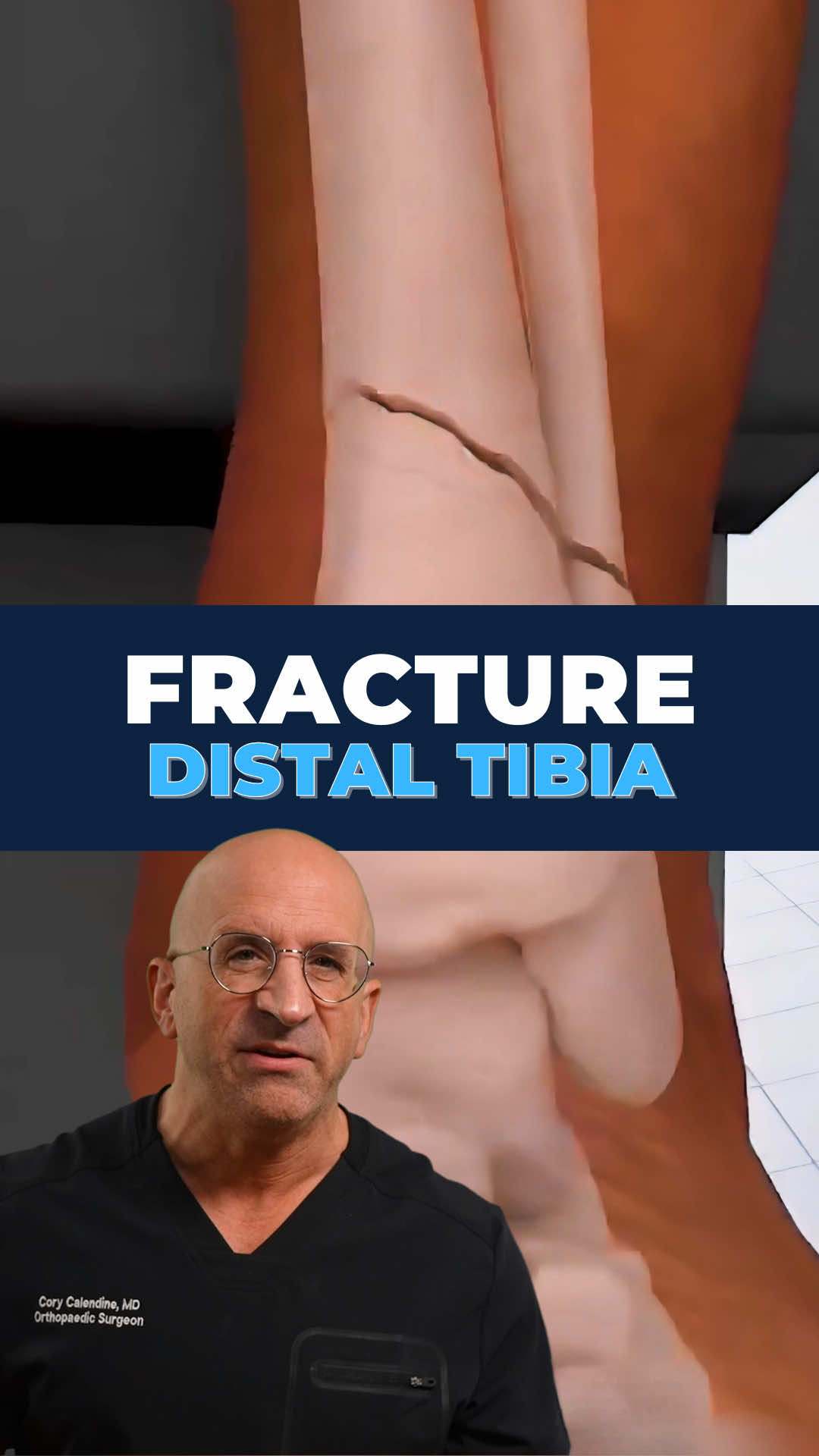 @Bone Doctor - Joint Pain MD