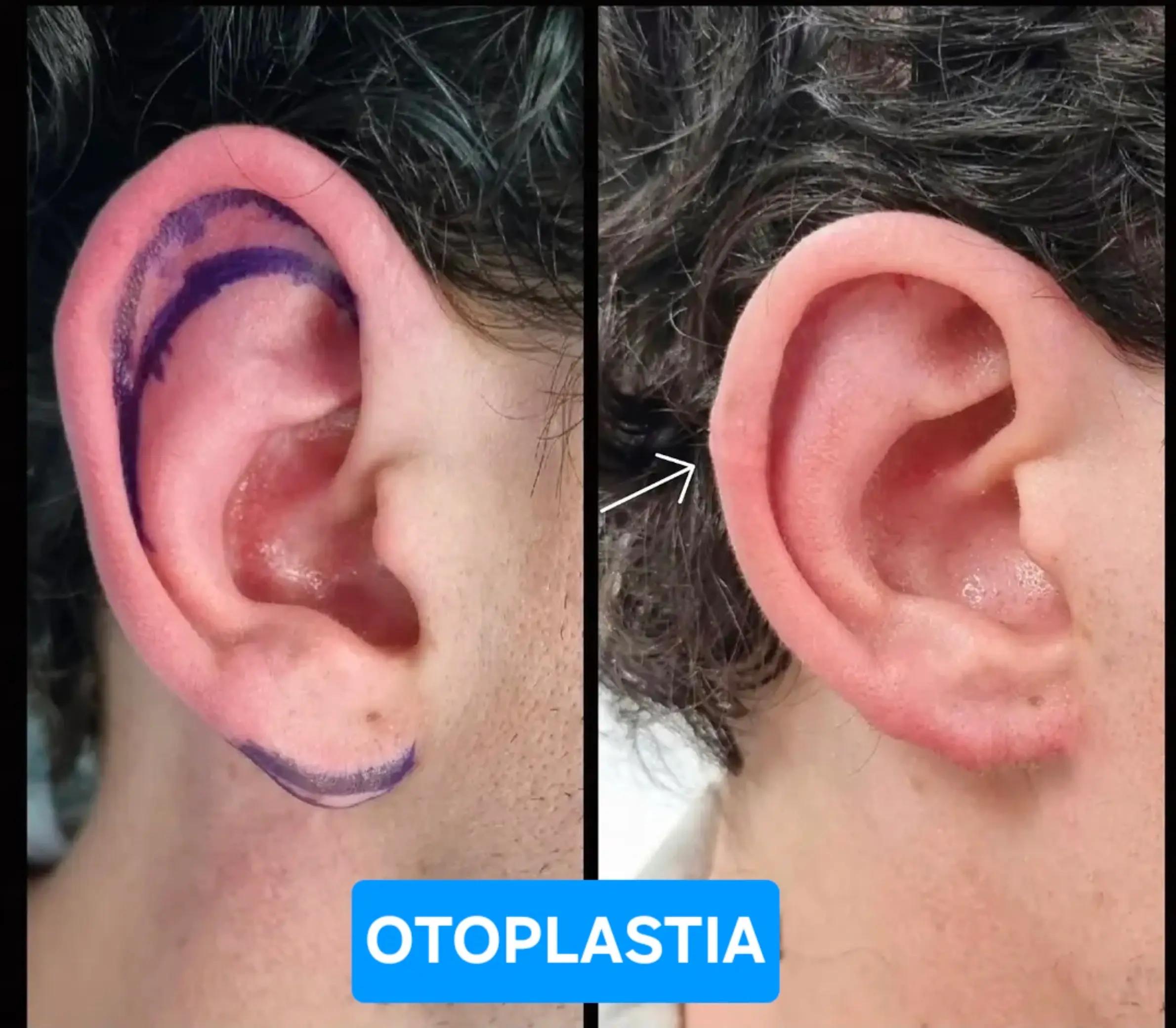 @Belanovacirugiaplastica
