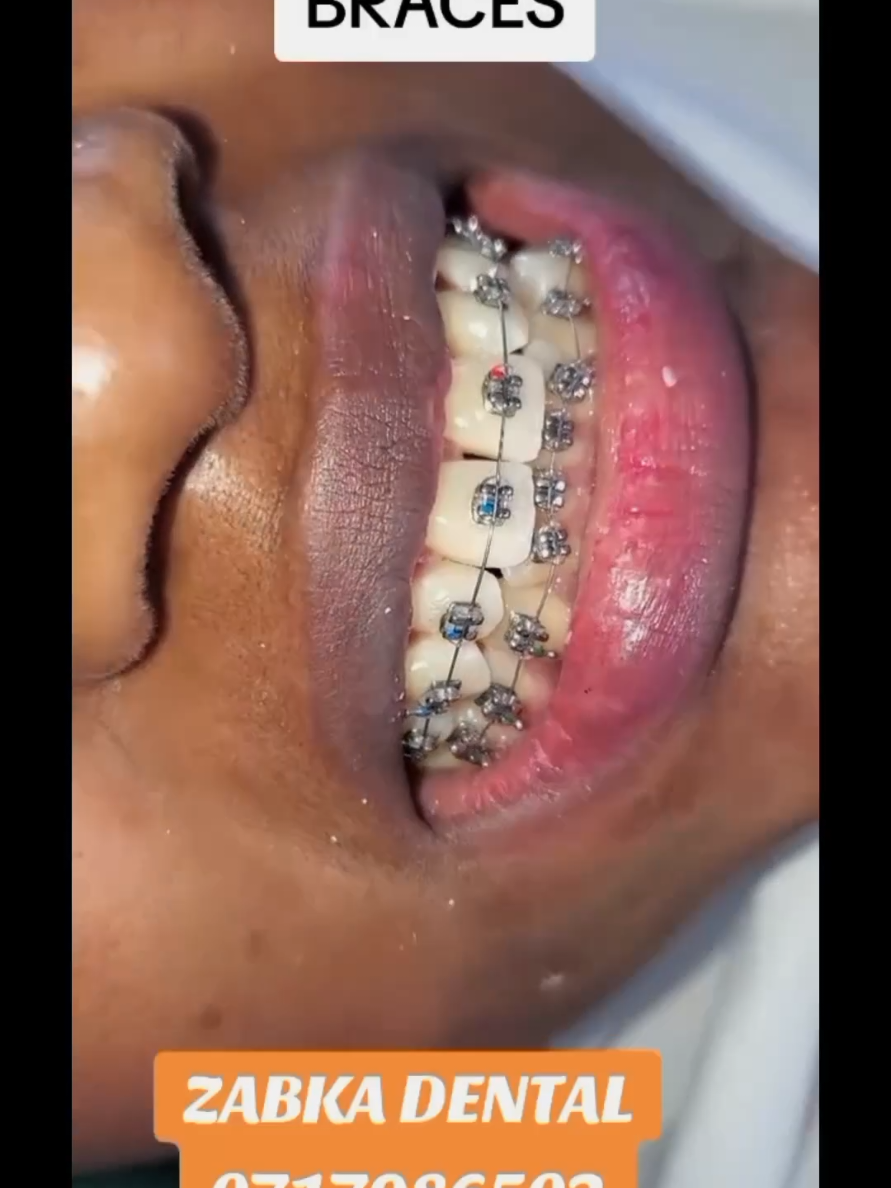 @Zabka Dental