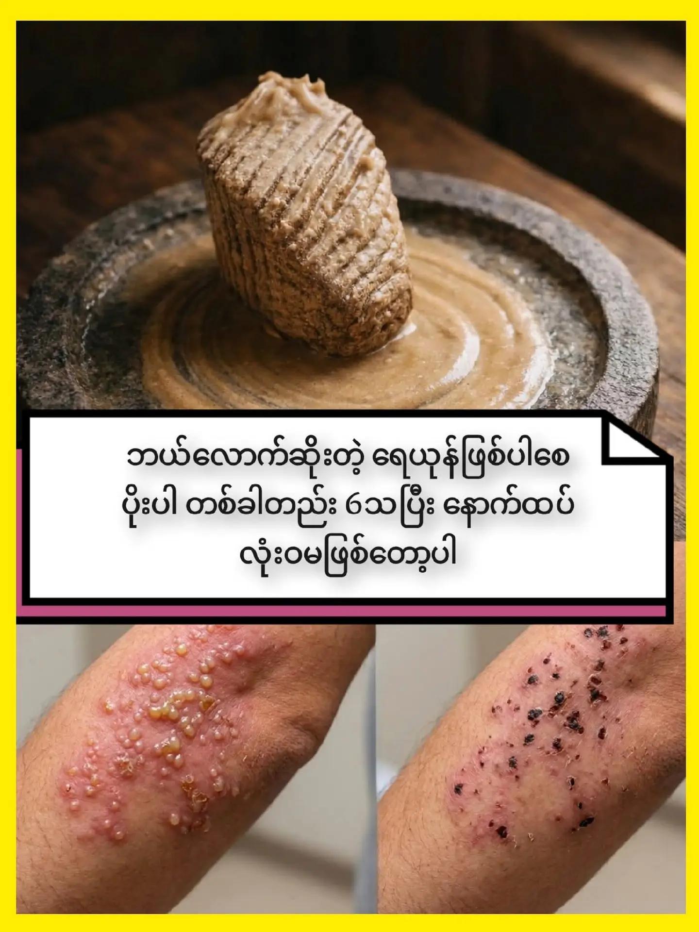 @ခင်