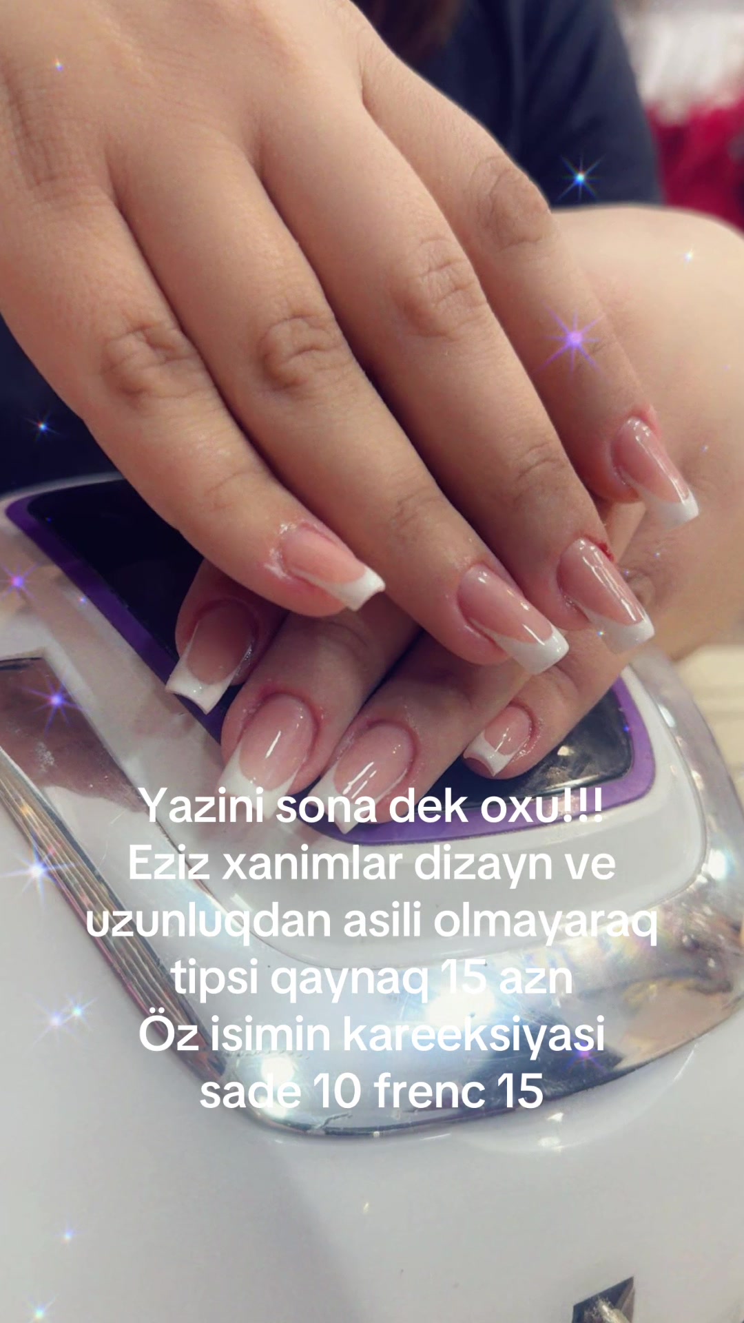@dirnaq qaynagi naxcivan