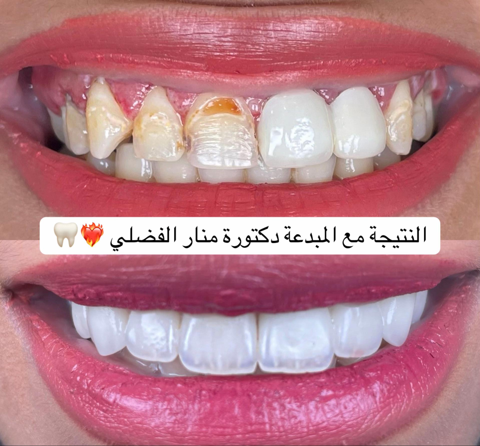 @عيادات راما
