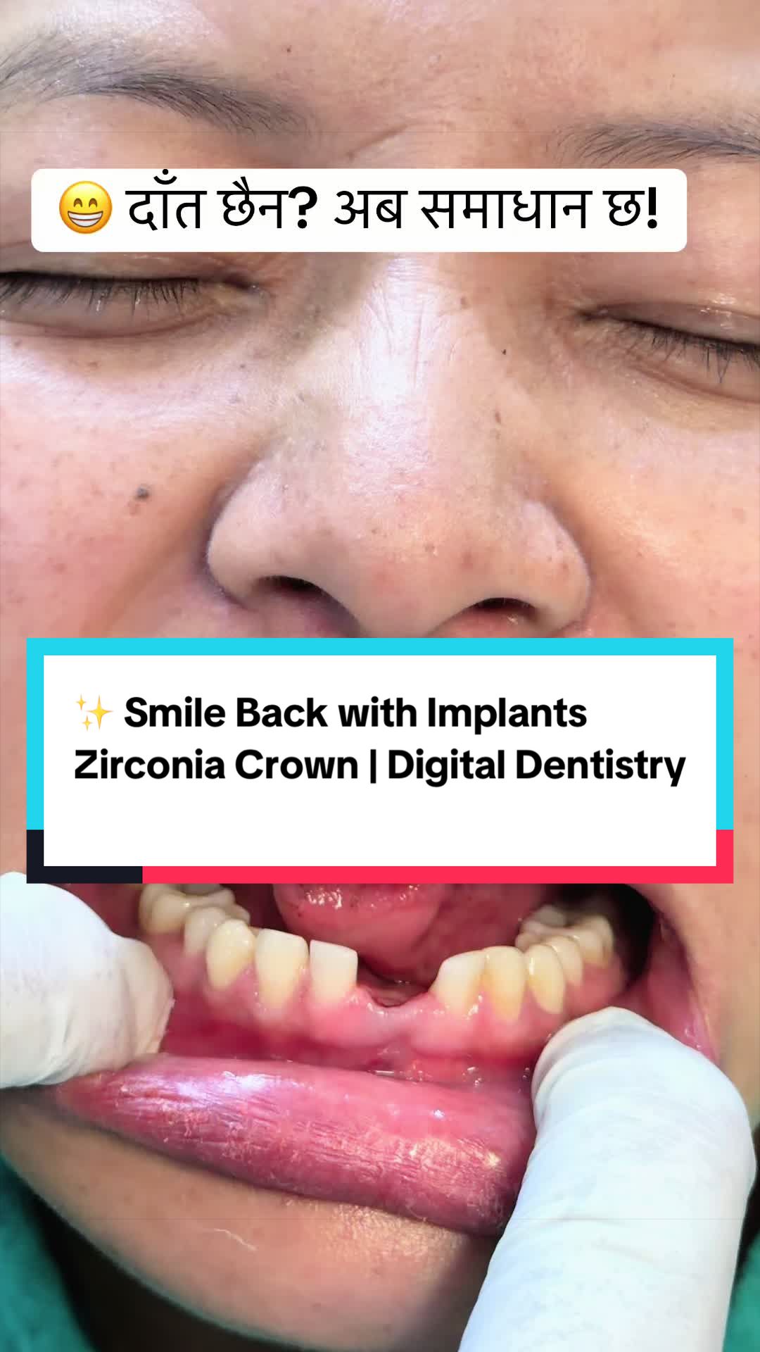 @Smile Engineer Dr Bidhan