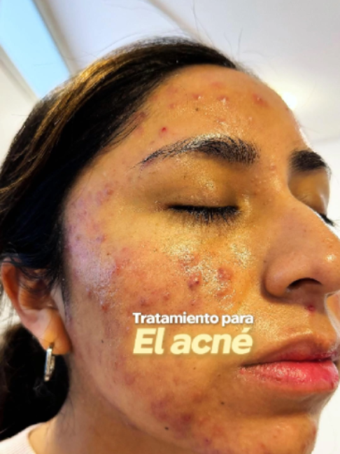 @RebellSpa