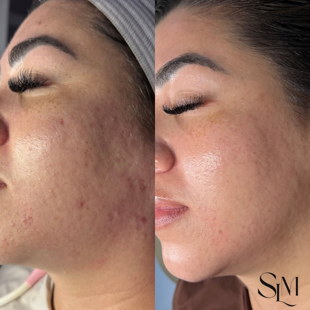 @Myrah | Midland Aesthetician