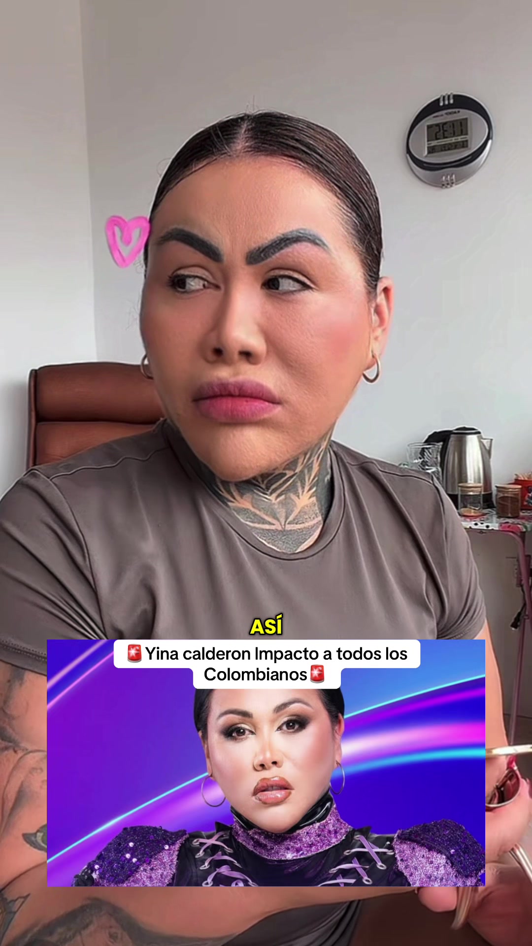 @Rz