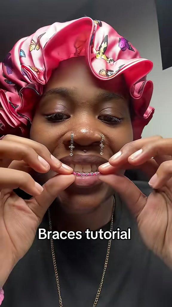 @Princessbracesplug🫶🏽🫆