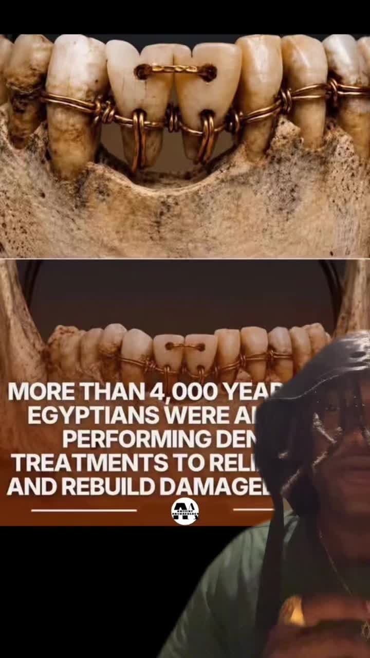 @Conscious Eye Open