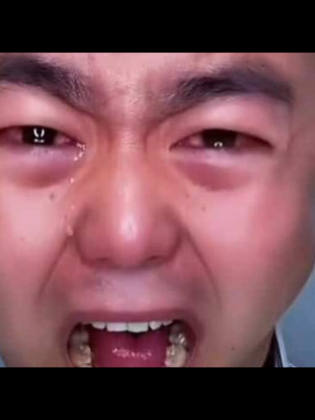 @보약신형만