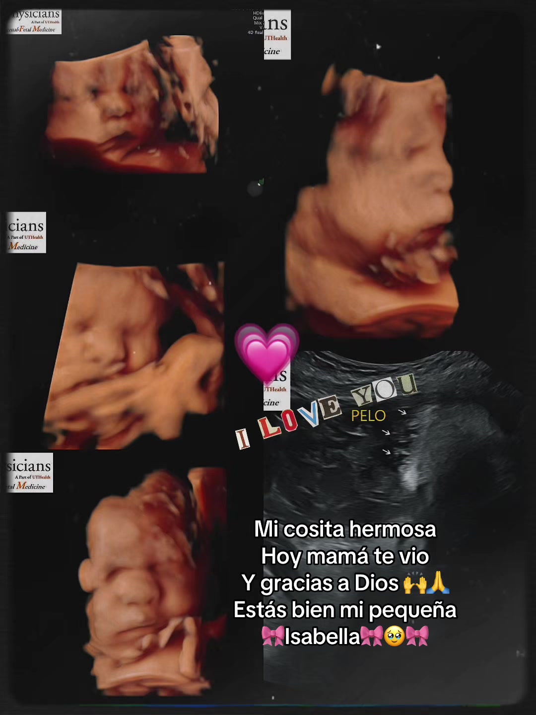 @Nelly🩷Isabella🎀💓