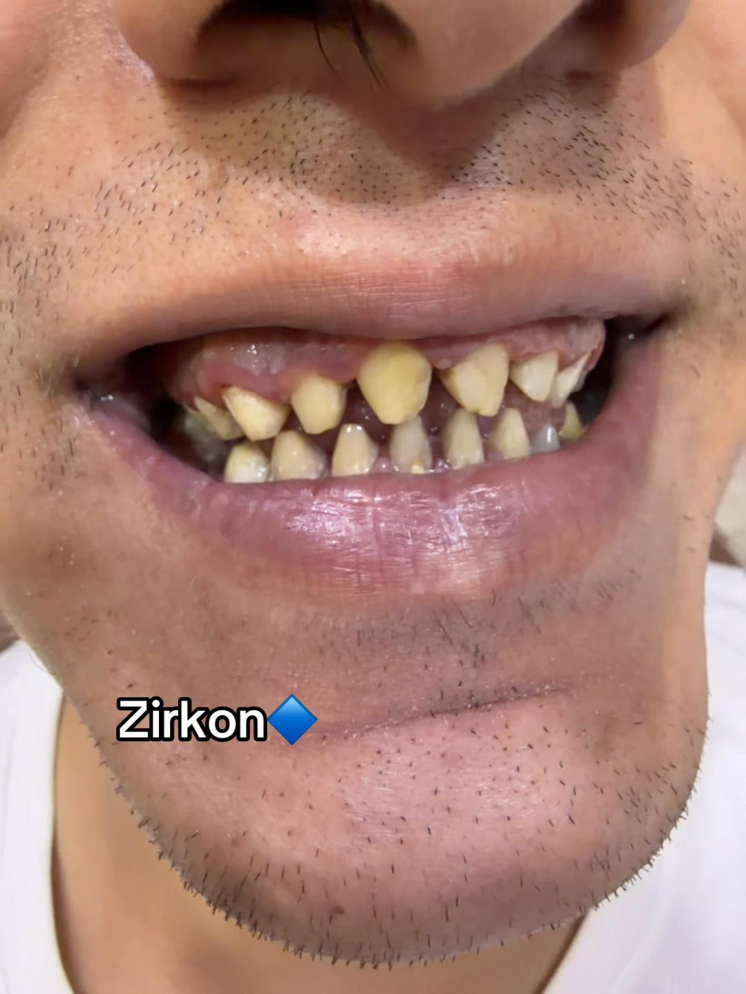 @stomatoloq  diş həkimi