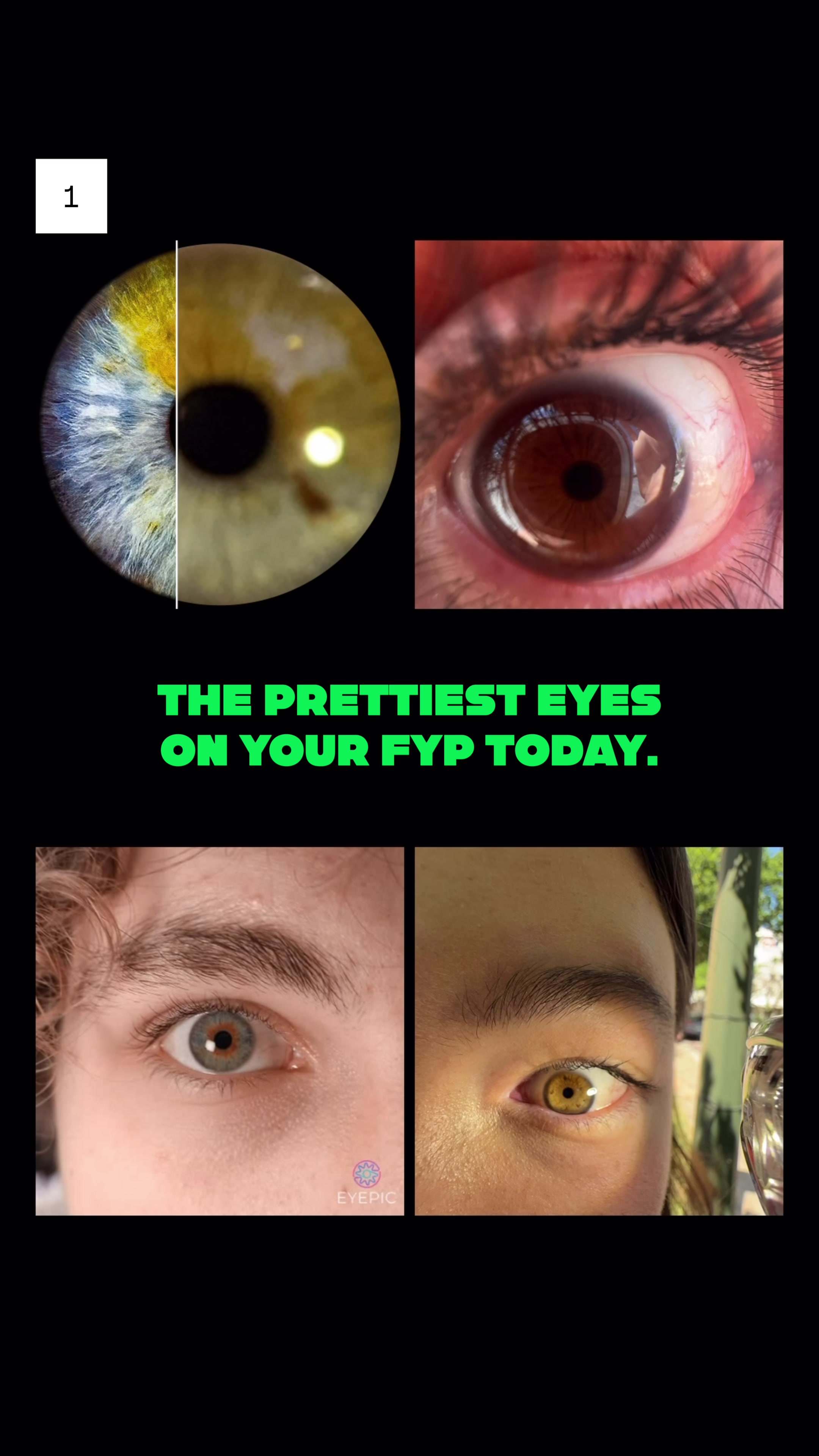 @Eyepic
