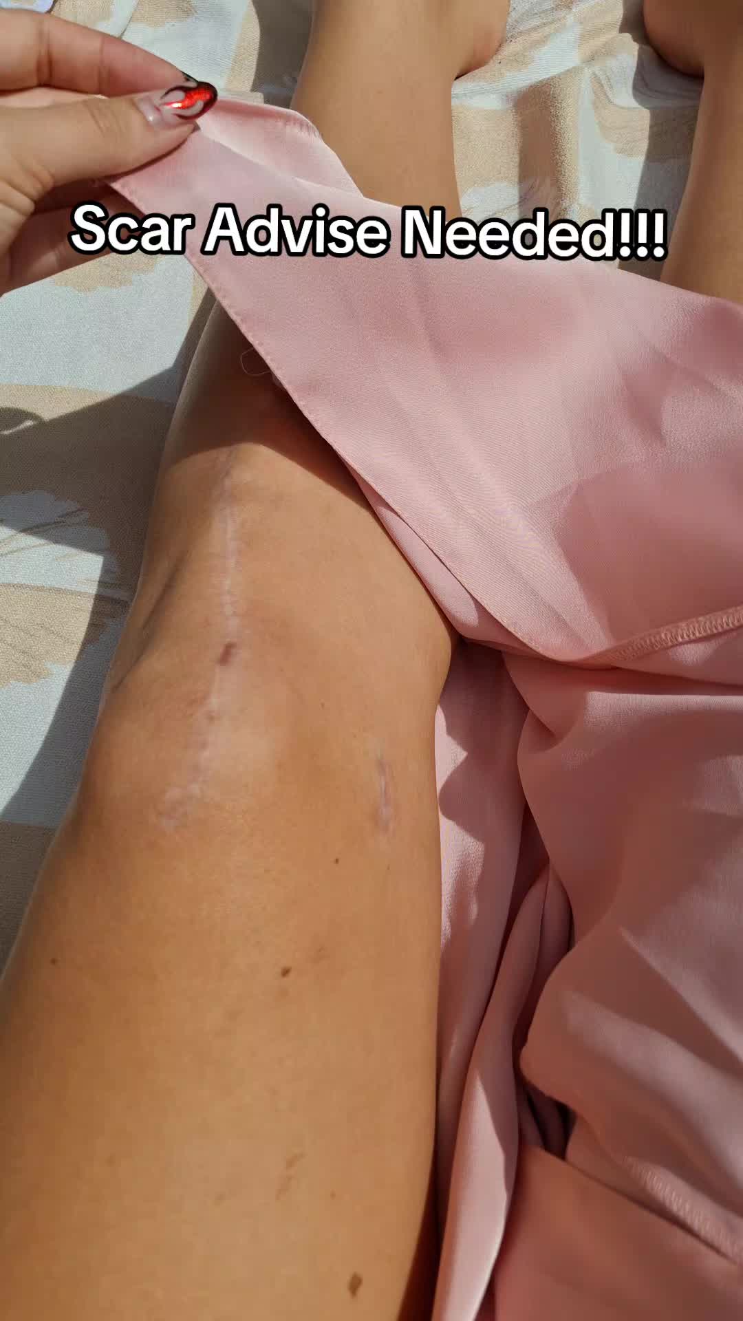 @Esther ♡ MPFL + TTO Recovery