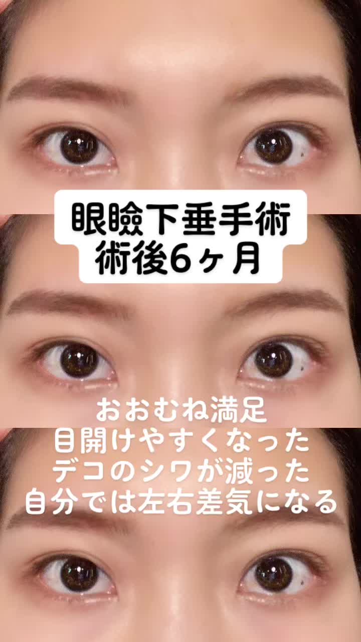 @igarashi