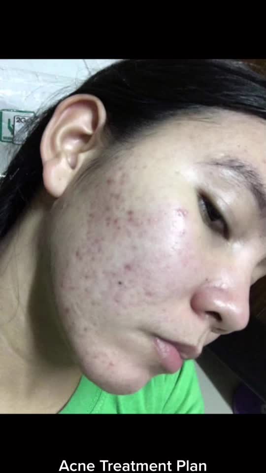 @user044310
