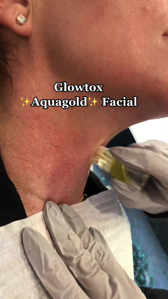 @Glowtox