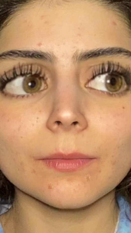 @Luisa Kuri