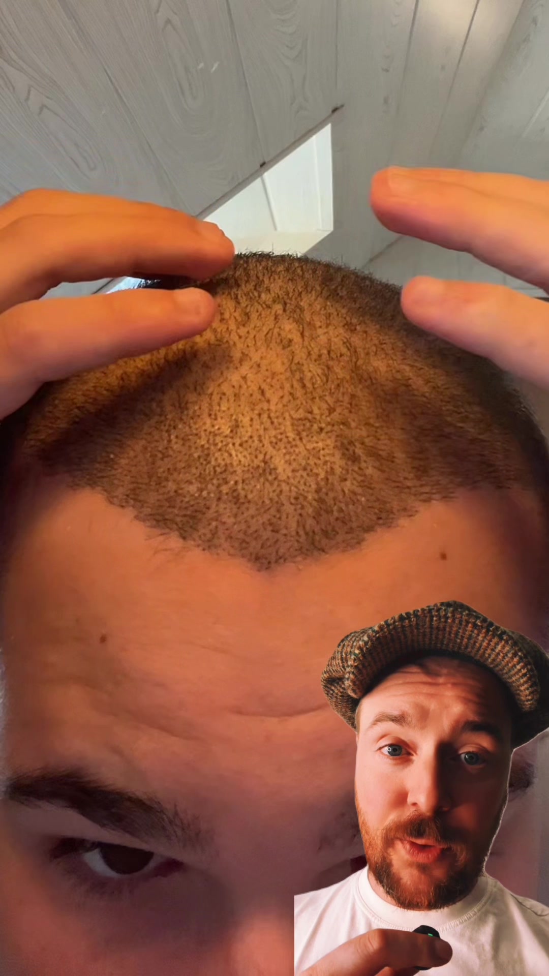 @RECOVRY Hair