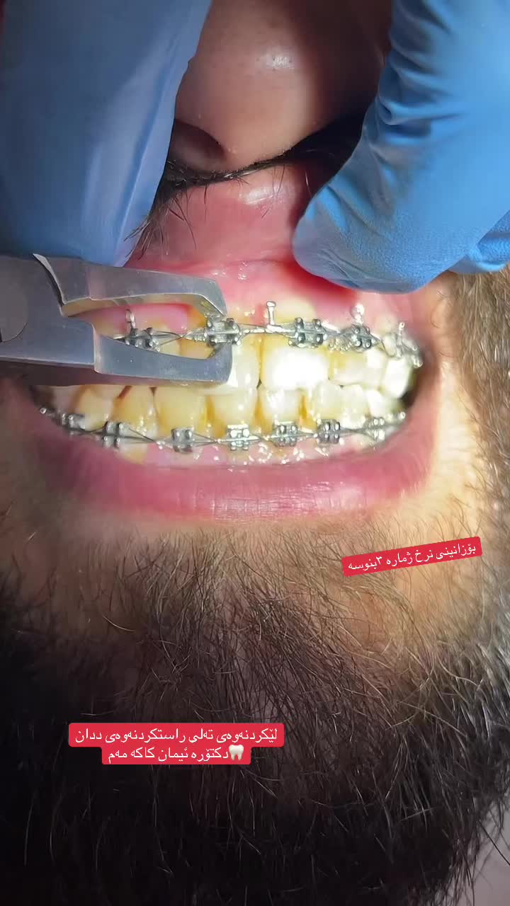 @🦷 دکتۆرە ئیمان کاکەمەم