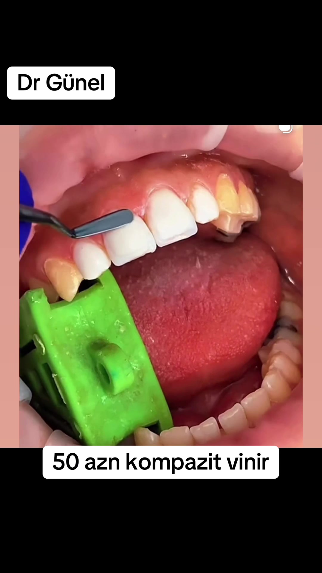 @Dentist_G&uuml;nel
