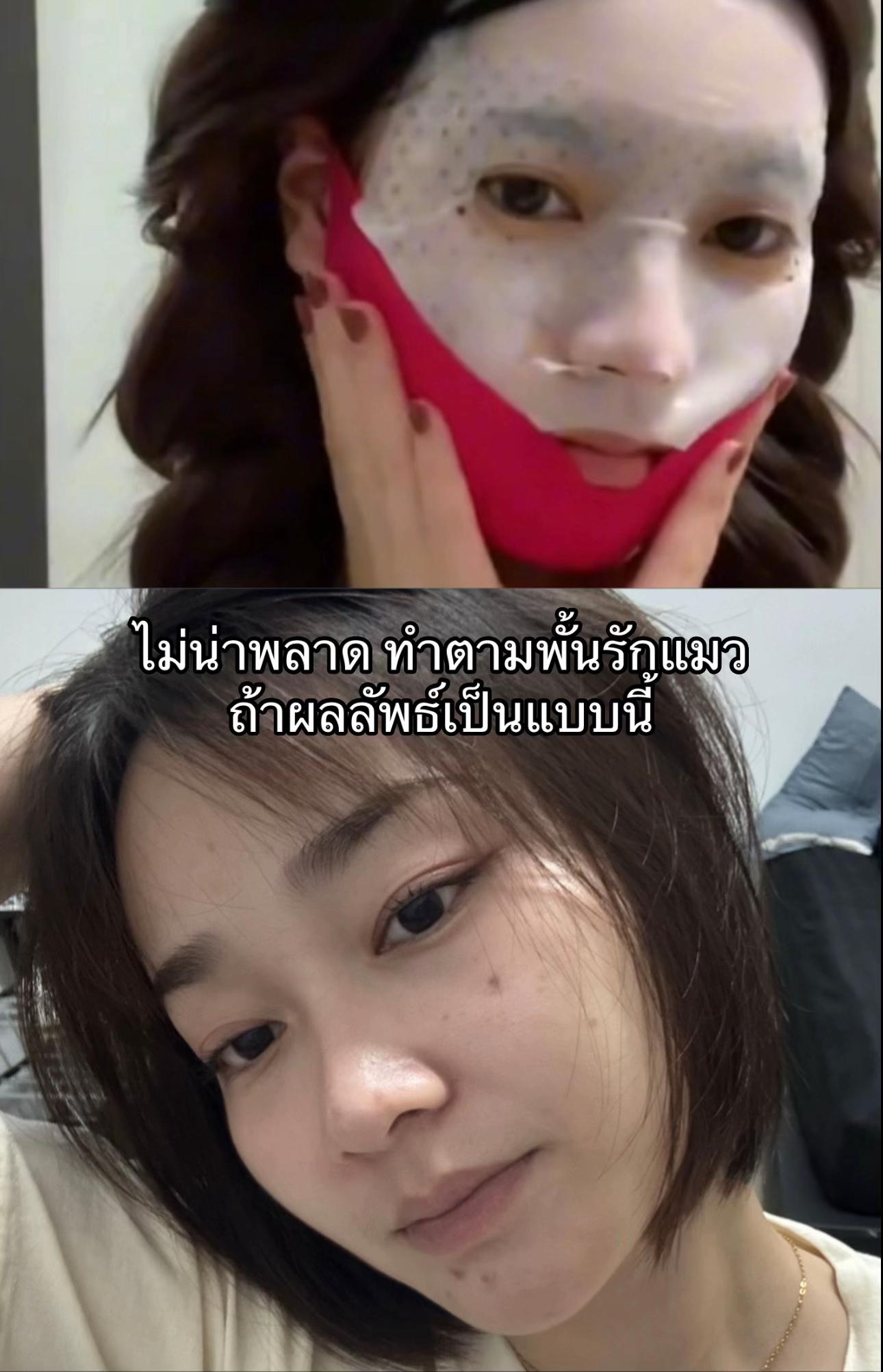 @ฟันก็หลอ
