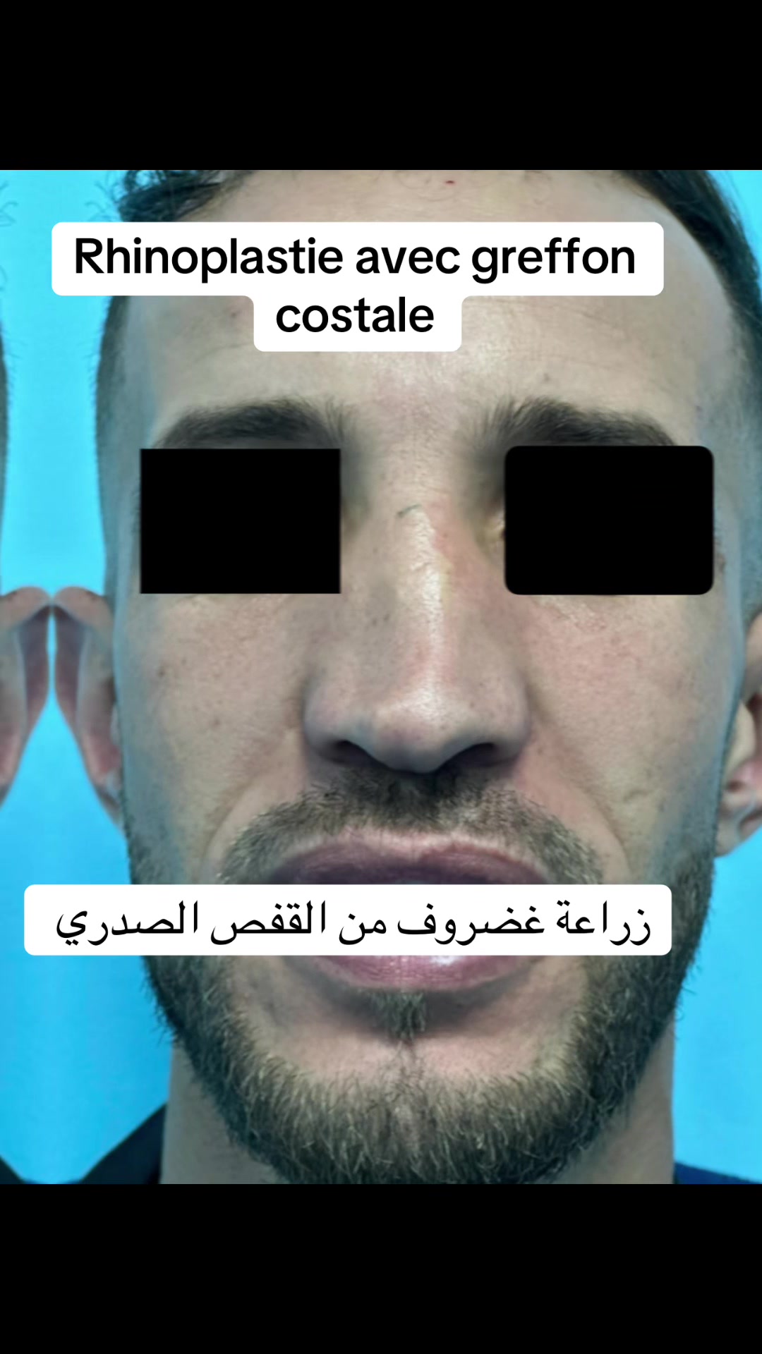 @Dr Larguet Abdelhak