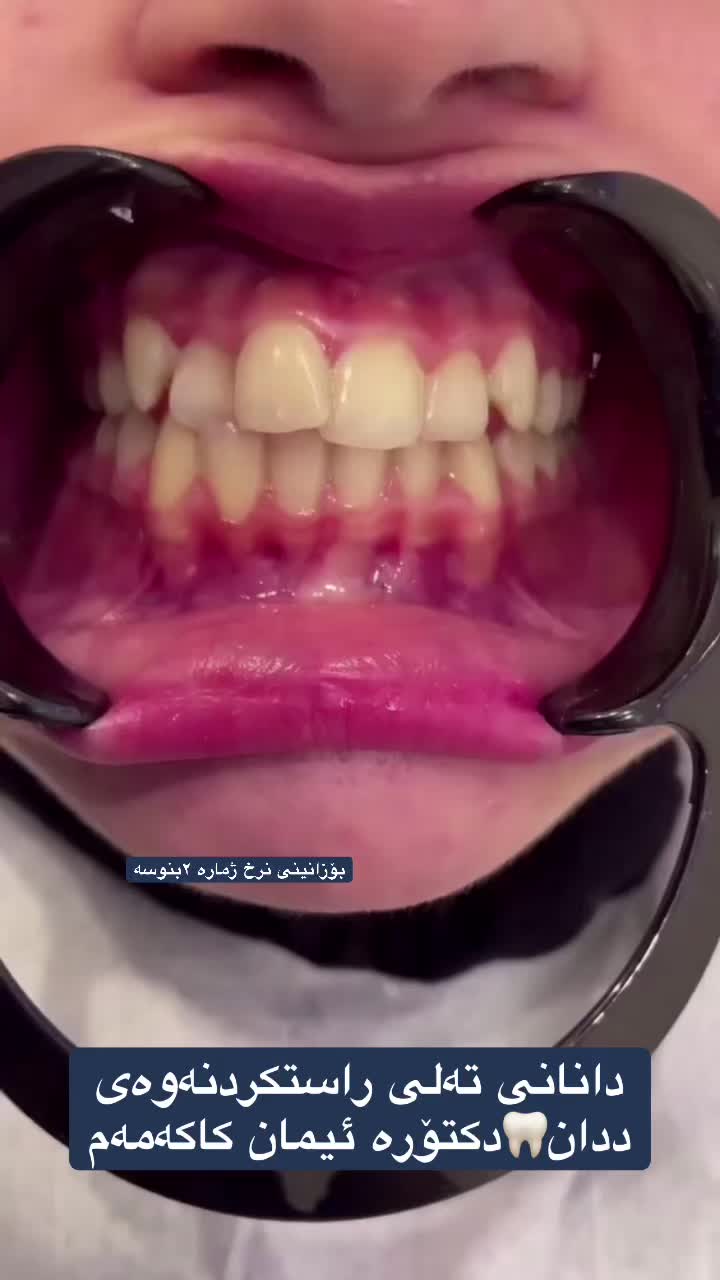 @🦷 دکتۆرە ئیمان کاکەمەم