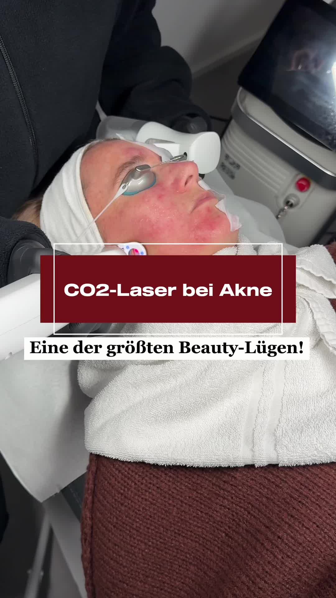 @Melissa | BEAUTYEXPERT