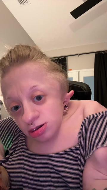 @Abby♿️