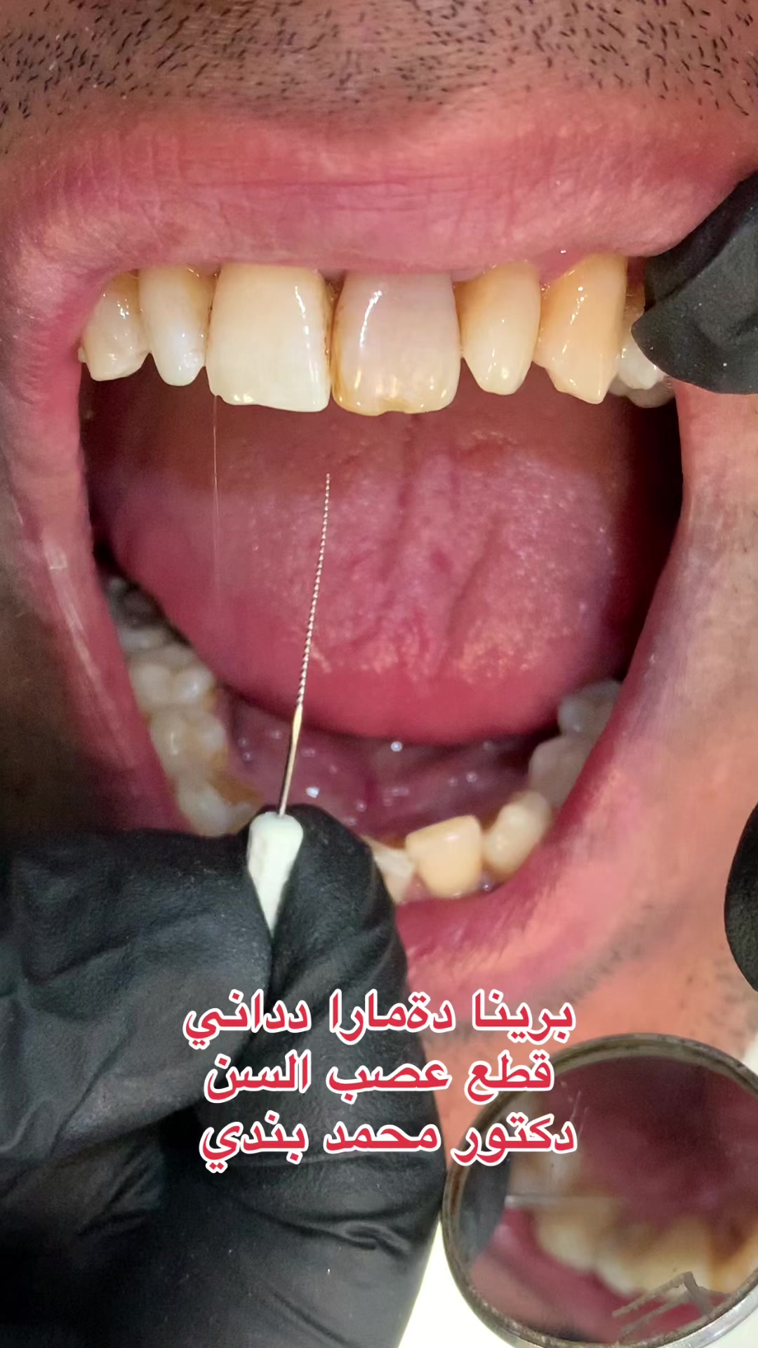 @Dr.Mohammed.Bandi