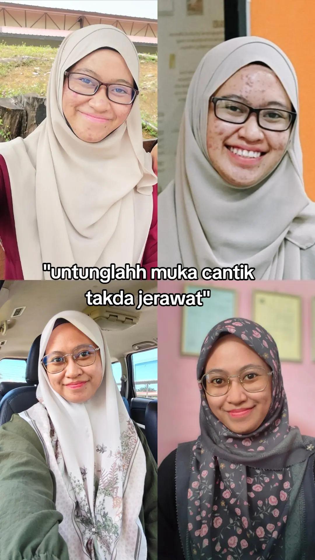@ekashariska