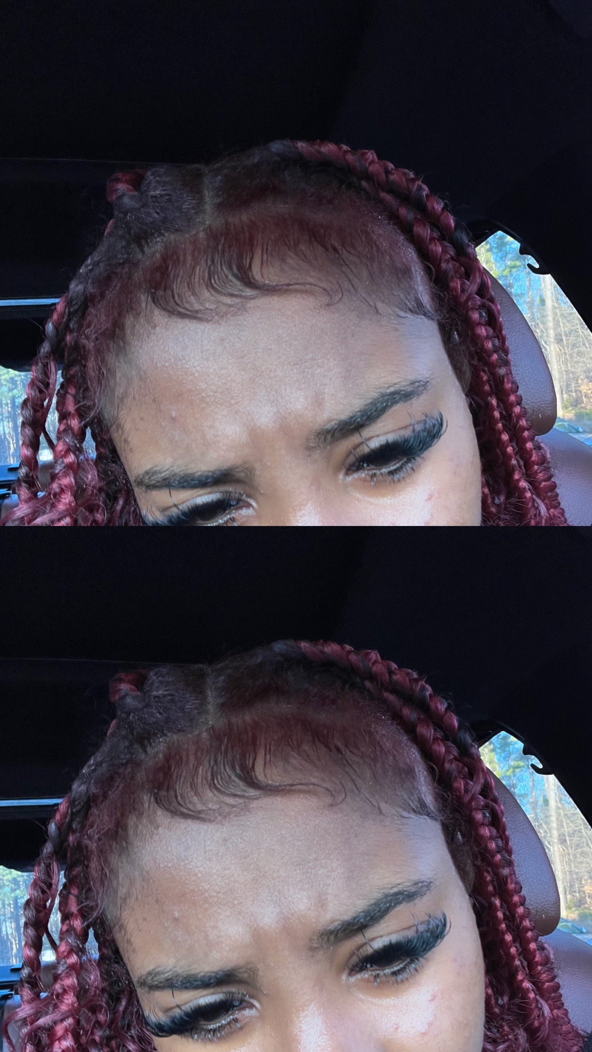 @&eacute;