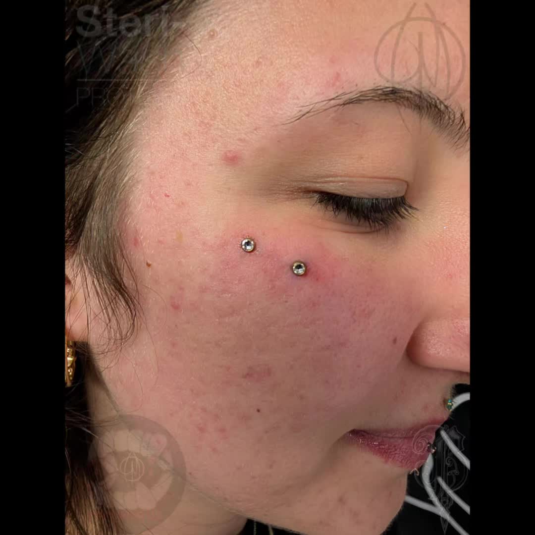 @Piercer Mike
