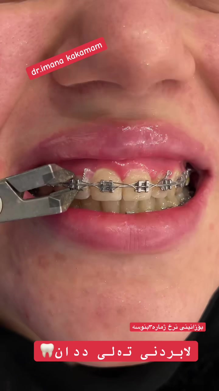 @🦷 دکتۆرە ئیمان کاکەمەم