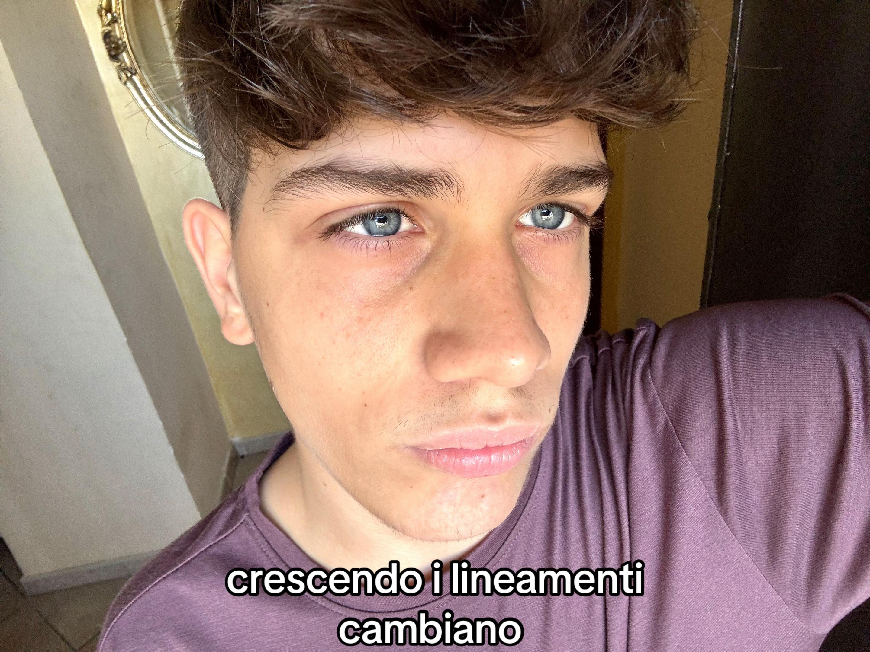 @777