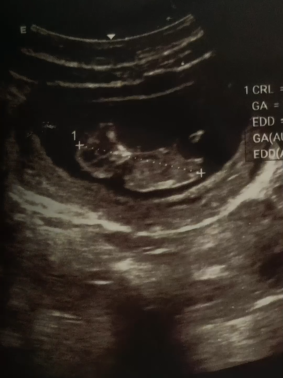 @˜”°•★𝙺𝙸𝙽𝙶 𝙾𝙵 𝚂𝚃𝚁★•°”˜