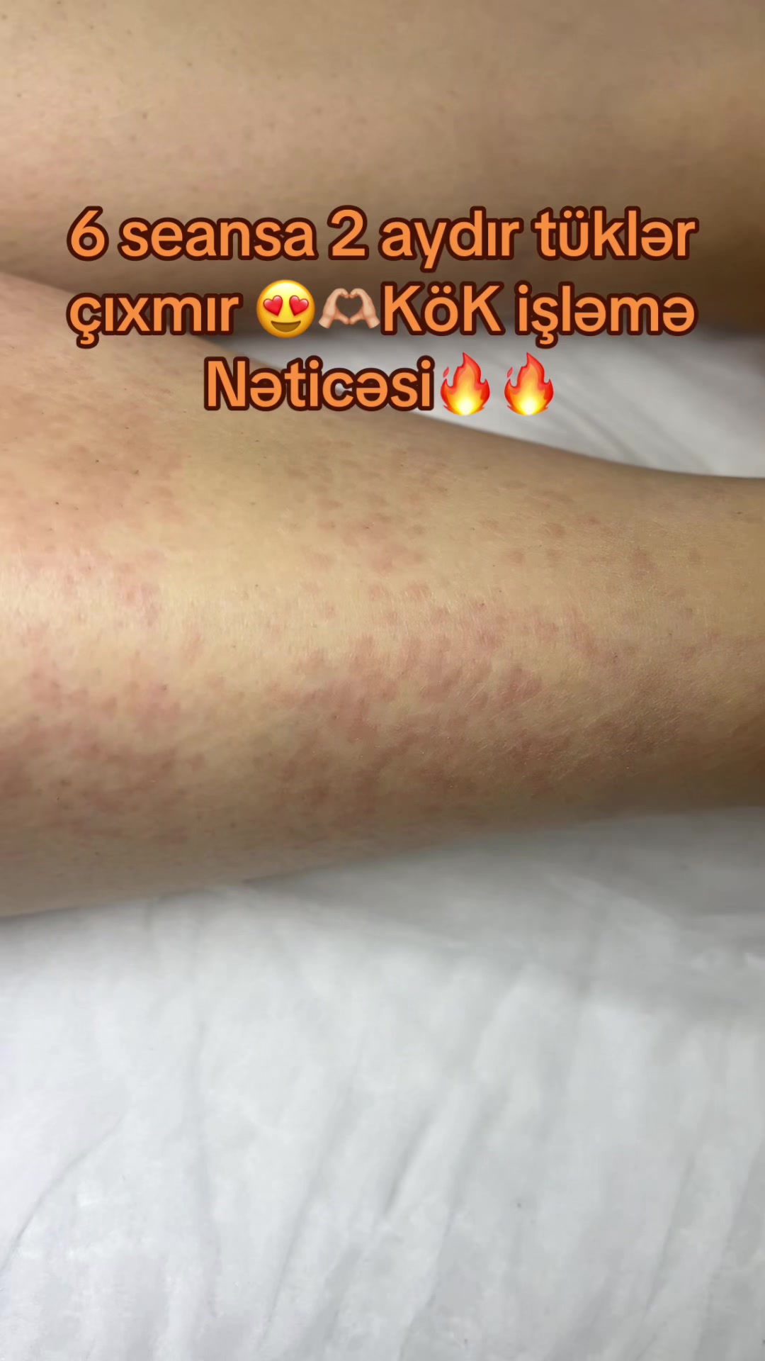 @jalelazeroloq