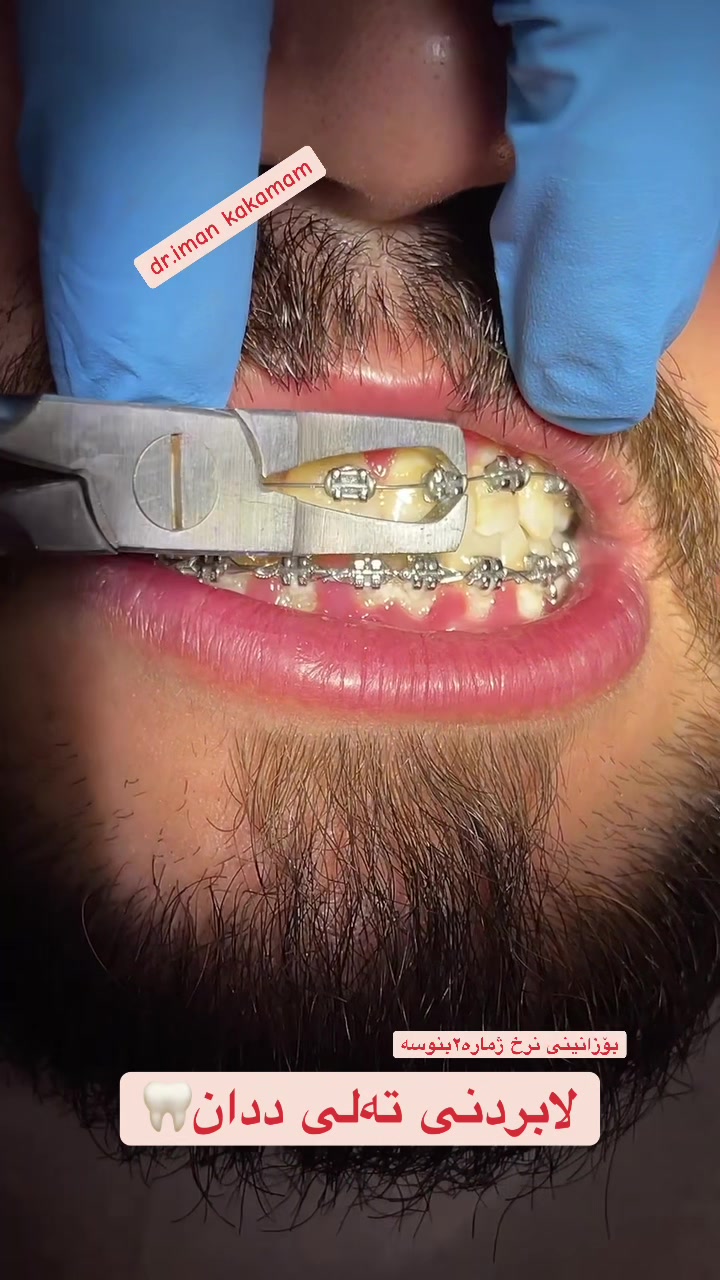 @🦷 دکتۆرە ئیمان کاکەمەم