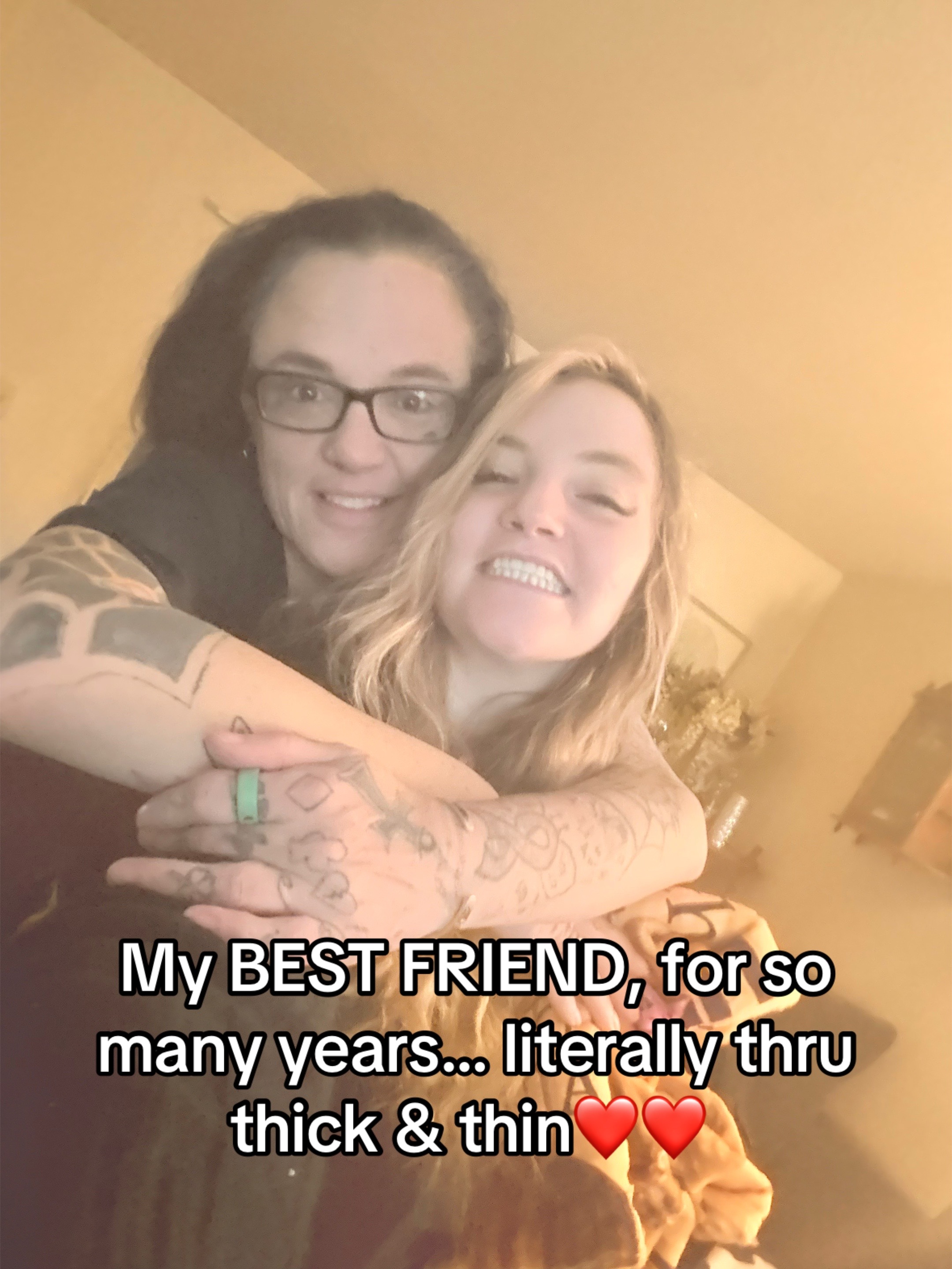@Hailey The Amputee