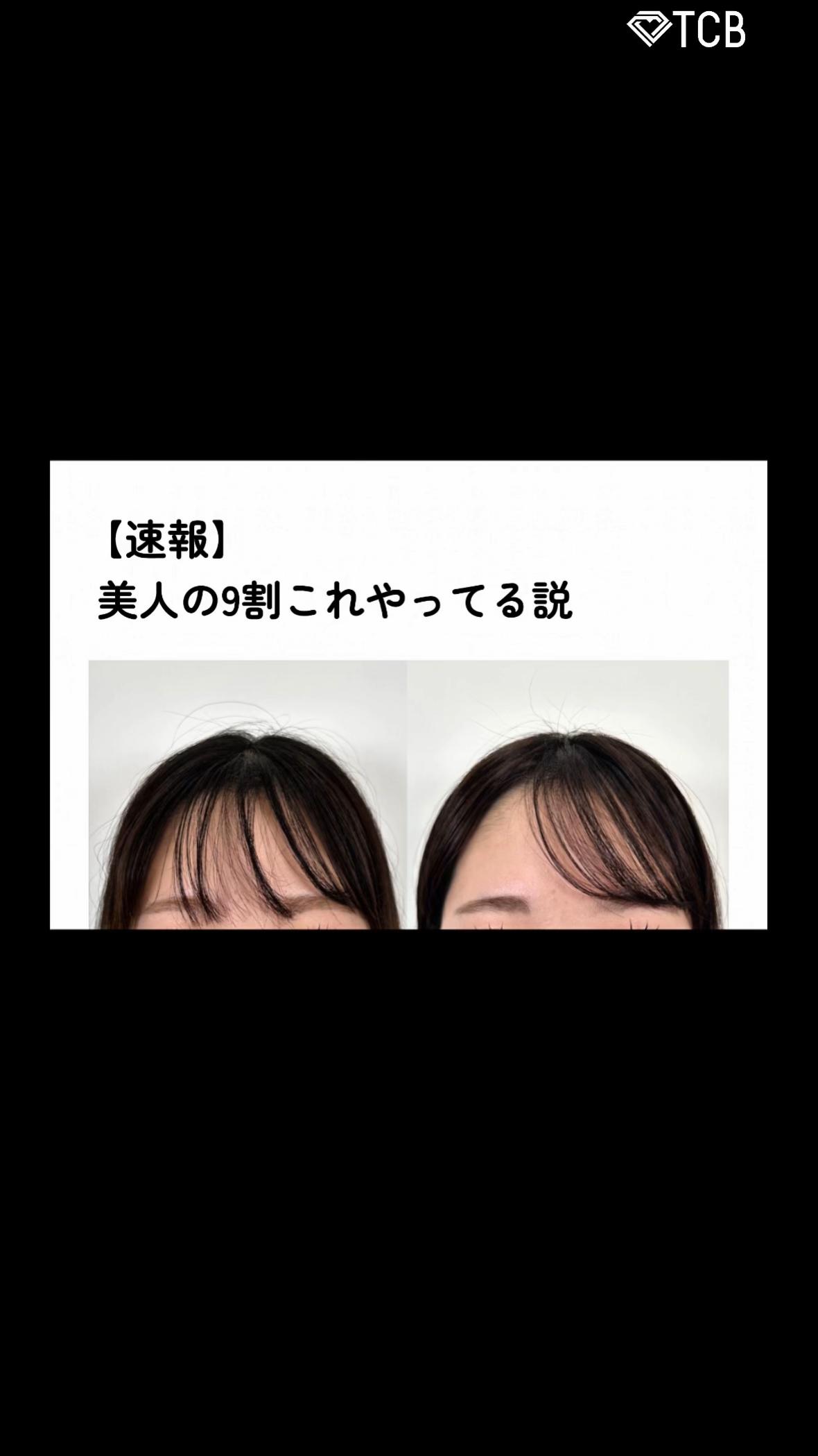 @【クマ取り/小顔整形】TCB京都駅前院 院長　橋本晋太朗