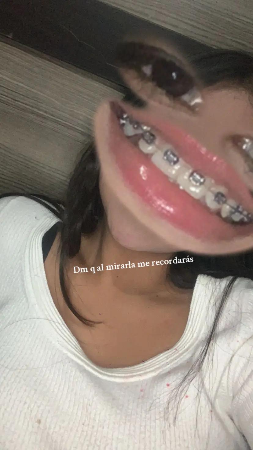 @🦑