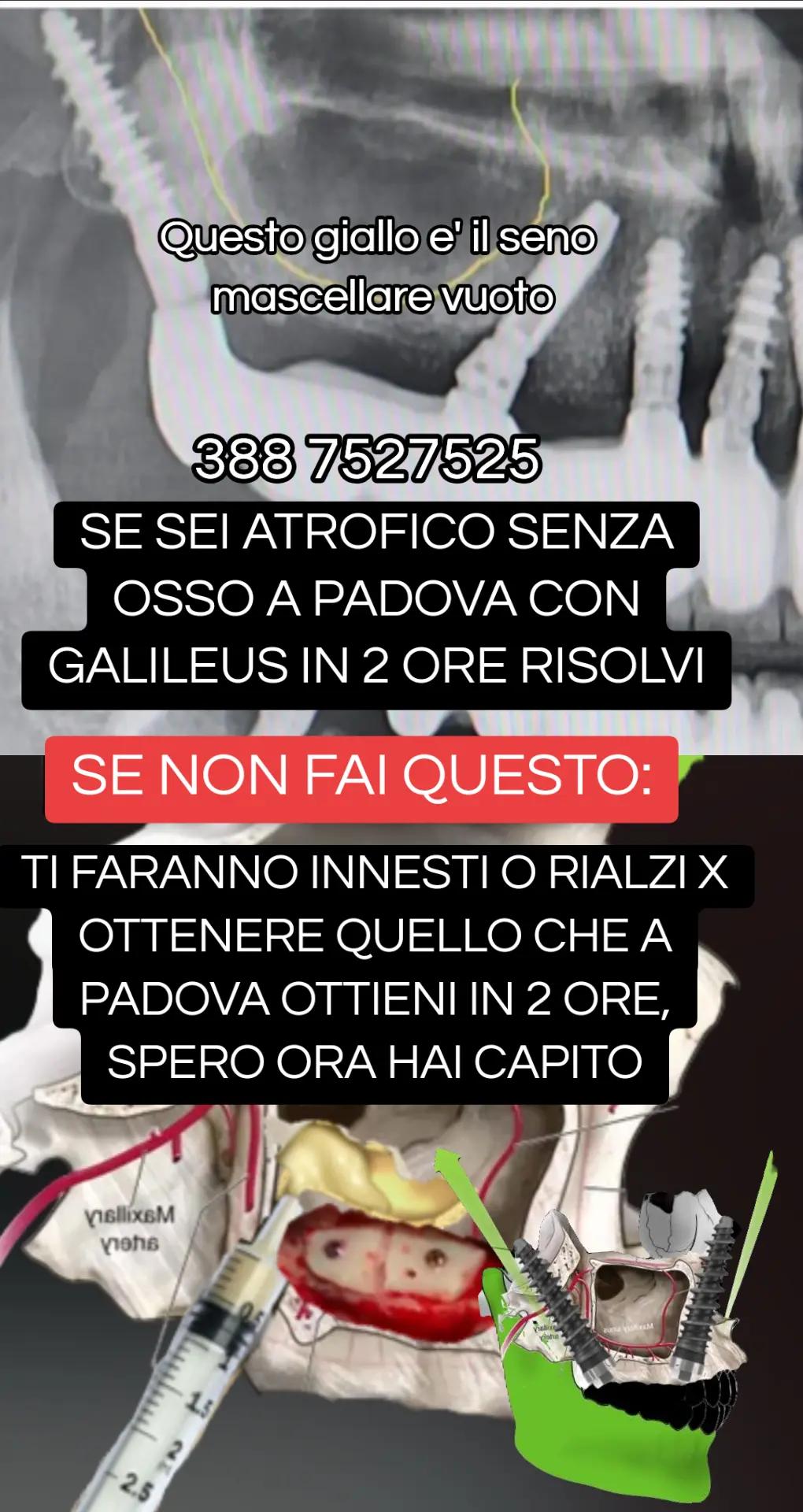 @Implantologiaprezzi