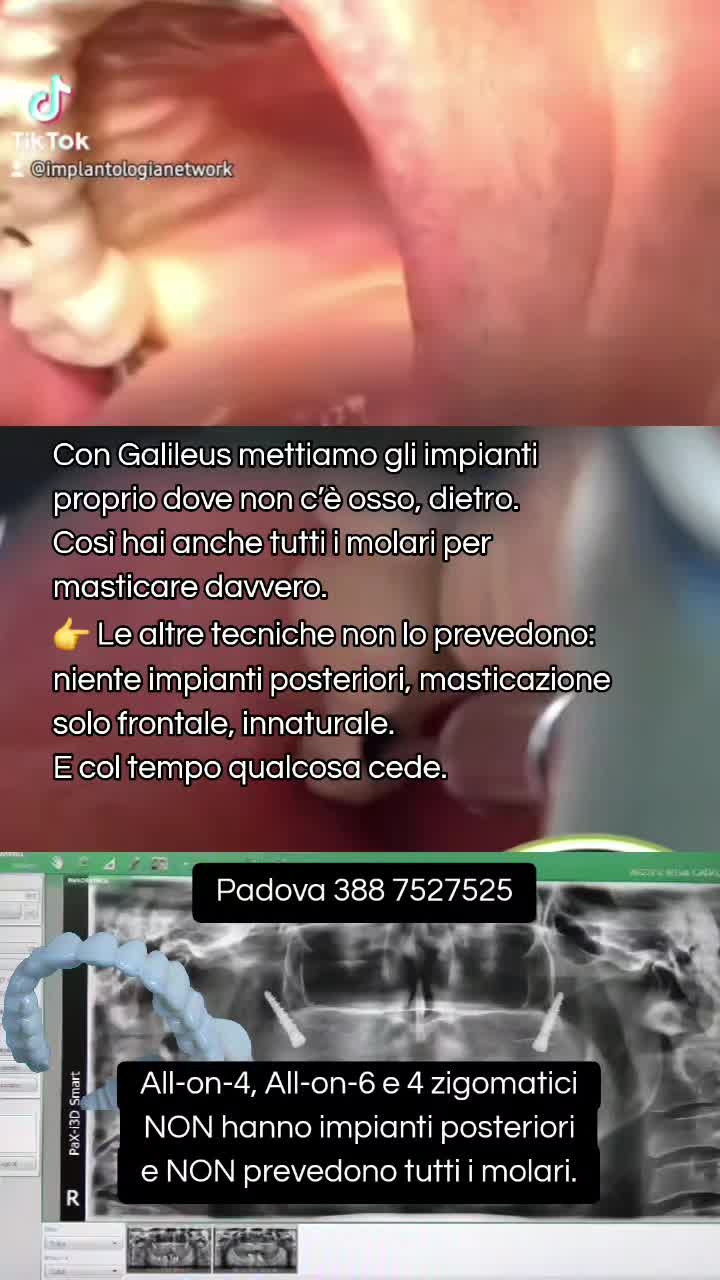@Implantologiaprezzi