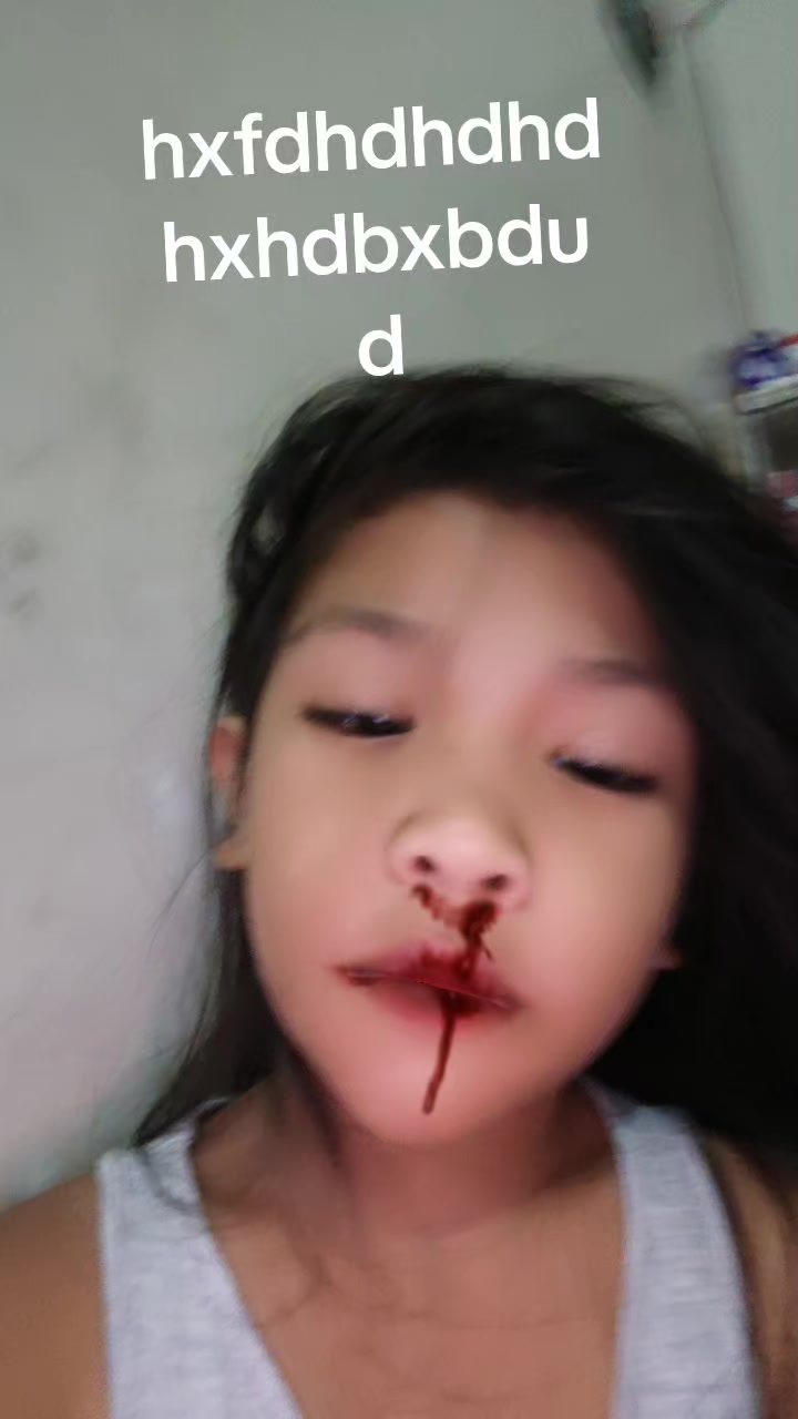 @Raffy