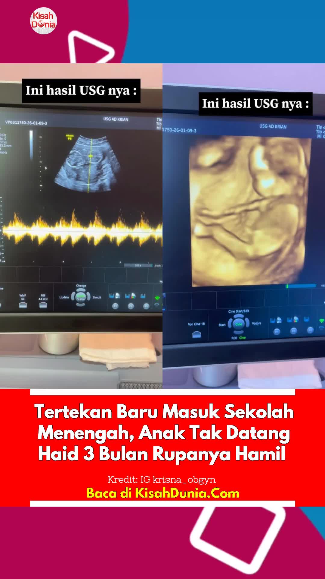@Kisah Dunia